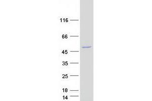Validation with Western Blot
