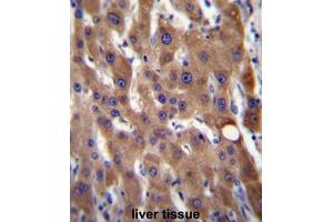 CIB4 Antibody (N-term) immunohistochemistry analysis in formalin fixed and paraffin embedded human liver tissue followed by peroxidase conjugation of the secondary antibody and DAB staining. (CIB4 anticorps  (N-Term))