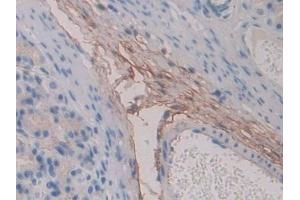 Detection of FBN1 in Rat Stomach Tissue using Polyclonal Antibody to Fibrillin 1 (FBN1) (Fibrillin 1 anticorps  (AA 751-895))