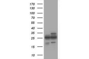 Image no. 1 for anti-Proteasome Subunit alpha 2 (PSMA2) (AA 50-234) antibody (ABIN1491570) (PSMA2 anticorps  (AA 50-234))