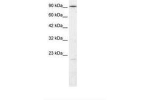 Image no. 2 for anti-Ligase IV, DNA, ATP-Dependent (LIG4) (AA 275-324) antibody (ABIN202951) (LIG4 anticorps  (AA 275-324))