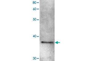 Detection of Shugoshin 1 protein by Western blotting.