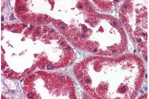 Human Kidney: Formalin-Fixed, Paraffin-Embedded (FFPE)