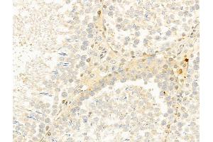 ABIN6261163 and ABIN6273037 at 1/100 staining Rat testis tissue by IHC-P. (CYLD anticorps  (C-Term))