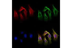 ABIN6259832 and ABIN6279098 staining Hela cells by IF/ICC. (AGXT2 anticorps  (Internal Region))