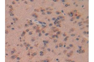 DAB staining on IHC-P; Samples: Mouse Brain Tissue (Pituitary Adenylate Cyclase Activating Peptide (AA 1-175) anticorps)