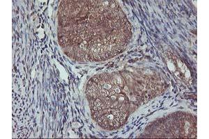 Image no. 1 for anti-V-Akt Murine Thymoma Viral Oncogene Homolog 1 (AKT1) antibody (ABIN1496554)