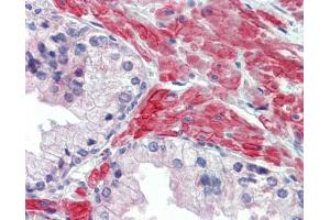 IHC-P Image Immunohistochemical analysis of paraffin-embedded human prostate, using 5HT2C Receptor, antibody(10 μg/ml).