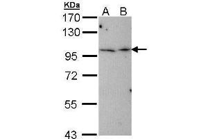WB Image Sample (30 ug of whole cell lysate) A: Hep G2 , B: Molt-4 , 7. (TBCK anticorps)
