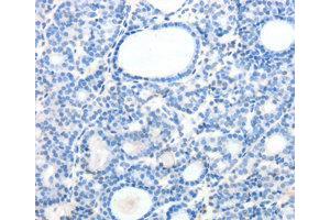 Immunohistochemistry (IHC) image for anti-Secretin Receptor (SCTR) antibody (ABIN1874706) (SCTR anticorps)