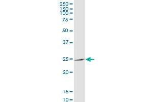 anti-Mitochondrial Ribosomal Protein S34 (MRPS34) (AA 1-218) antibody