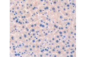 Used in DAB staining on fromalin fixed paraffin- embedded liver tissue (TSSK1 anticorps  (AA 57-314))