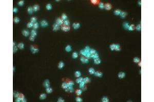 Image no. 3 for anti-Hypoxia Inducible Factor 1, alpha Subunit (Basic Helix-Loop-Helix Transcription Factor) (HIF1A) (AA 329-530) antibody (ABIN363210)