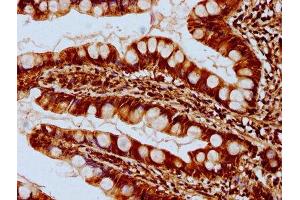IHC image of ABIN7171134 diluted at 1:300 and staining in paraffin-embedded human small intestine tissue performed on a Leica BondTM system.
