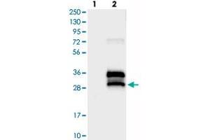 Western blot analysis of Lane 1: Negative control (vector only transfected HEK293T lysate), Lane 2: Over-expression Lysate (Co-expressed with a C-terminal myc-DDK tag (~3. (BRICD5 anticorps)