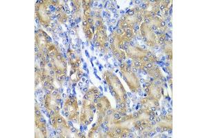 Immunohistochemistry of paraffin-embedded rat kidney using CRYAA antibody (ABIN5973354) at dilution of 1/200 (40x lens). (CRYAA anticorps)