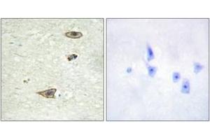 Immunohistochemistry analysis of paraffin-embedded human brain tissue, using GRK1 (Ab-21) Antibody. (GRK1 anticorps  (AA 6-55))