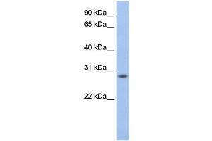 Western Blotting (WB) image for anti-MPV17 Mitochondrial Membrane Protein-Like 2 (MPV17L2) antibody (ABIN2459191) (MPV17L2 anticorps)
