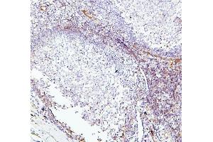 IHC analysis of TEK using anti-TEK antibody (ABIN7600762). (TEK anticorps  (AA 23-616))