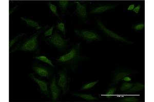 Immunofluorescence of monoclonal antibody to ATP2A1 on HeLa cell.