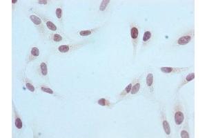 Immunocytochemistry analysis of ABIN7127304 diluted at 1:100 and staining in Hela cells performed on a Leica BondTM system.