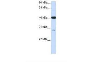 Image no. 1 for anti-Glutaryl-CoA Dehydrogenase (GCDH) (AA 146-195) antibody (ABIN6738082) (GCDH anticorps  (AA 146-195))