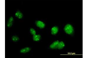 Immunofluorescence of purified MaxPab antibody to PRDM15 on HeLa cell. (PRDM15 anticorps  (AA 1-1141))