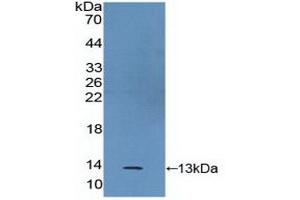 Western blot analysis of recombinant Human S100A2. (S100A2 anticorps  (AA 2-98))