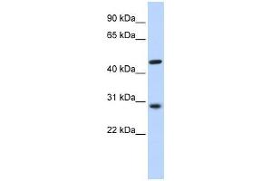 PYGO2 antibody used at 0.