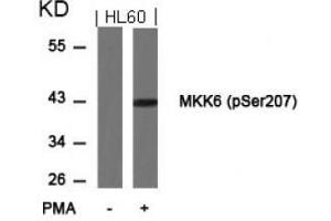 Image no. 3 for anti-Mitogen-Activated Protein Kinase Kinase 6 (MAP2K6) (pSer207) antibody (ABIN196865) (MAP2K6 anticorps  (pSer207))