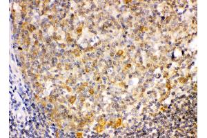 anti-Tribbles Pseudokinase 2 (TRIB2) (AA 175-211), (Middle Region) antibody