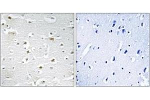 Immunohistochemistry analysis of paraffin-embedded human brain tissue, using DDX3Y Antibody. (DDX3Y anticorps  (AA 41-90))