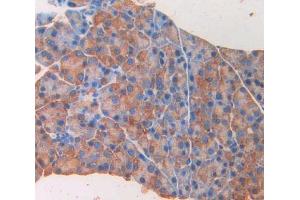IHC-P analysis of pancreas tissue, with DAB staining. (GAD anticorps  (AA 1-97))