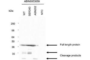 Detection of N protein. (Recombinant SARS-CoV-2 Nucleocapsid anticorps)