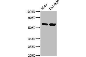 Western Blot Positive WB detected in: A549 whole cell lysate, Colo320 whole cell lysate All lanes: PDILT antibody at 4. (PDILT anticorps  (AA 494-584))