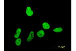 Immunofluorescence of purified MaxPab antibody to GTF2I on HeLa cell. (GTF2I anticorps  (AA 1-976))