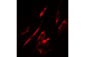 ABIN6274289 staining HeLa cells by IF/ICC. (MAPK10 anticorps  (C-Term))