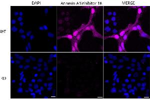 Immunocytochemical staining of Hela cells using Annexin A1 antibody (ABIN7797614), 1:1,000), Top panel: wild-type (WT), Bottom panal: Annexin A1 shRNA knockdown (KD). (Recombinant Annexin a1 anticorps)
