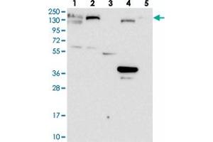 Western blot analysis of Lane 1: RT-4, Lane 2: U-251 MG, Lane 3: Human Plasma, Lane 4: Liver, Lane 5: Tonsil with GOLGA3 polyclonal antibody  at 1:100-1:250 dilution. (Golgin A3 anticorps)