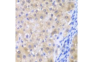 Immunohistochemistry of paraffin-embedded human liver injury using GPX4 antibody (ABIN6294188) at dilution of 1:200 (40x lens). (GPX4 anticorps)