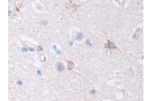Detection of F8 in Human Cerebrum Tissue using Polyclonal Antibody to Coagulation Factor VIII (F8)