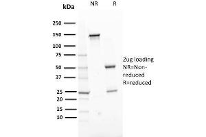 SDS-PAGE Analysis Purified ERCC1 Mouse Monoclonal Antibody (ERCC1/2318).