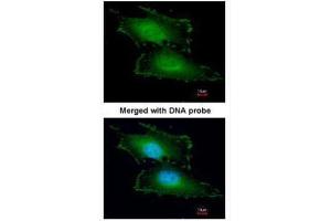 ICC/IF Image Immunofluorescence analysis of paraformaldehyde-fixed HeLa, using Peflin, antibody at 1:200 dilution. (PEF1 anticorps)