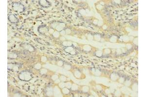 Immunohistochemistry of paraffin-embedded human small intestine tissue using ABIN7162022 at dilution of 1:100