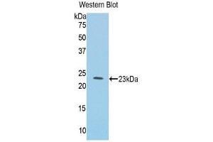 Western Blotting (WB) image for anti-Interleukin 1 Receptor-Like 1 (IL1RL1) (AA 357-532) antibody (ABIN1859396)
