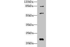 Western blot All lanes: PYHIN1 antibody at 6 μg/mL + Mouse small intestine tissue Secondary Goat polyclonal to rabbit IgG at 1/10000 dilution Predicted band size: 56, 55, 52, 51, 27, 26 kDa Observed band size: 56, 22, 84 kDa (PYHIN1 anticorps  (AA 1-245))