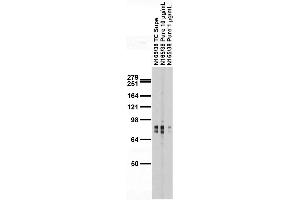 Adult rat brain membrane immunoblot.