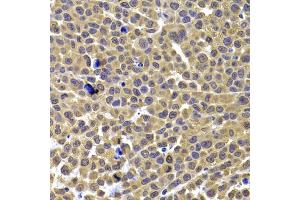Immunohistochemistry of paraffin-embedded mouse cancer using ARID3A antibody (ABIN5975618) at dilution of 1/100 (40x lens). (ARID3A anticorps)
