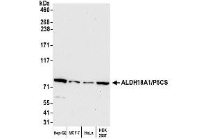 Western Blotting (WB) image for anti-Aldehyde Dehydrogenase 18 Family, Member A1 (ALDH18A1) (AA 575-625) antibody (ABIN7449868) (P5CS anticorps  (AA 575-625))