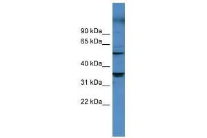 CYP11B1 antibody used at 0. (CYP11B1 anticorps  (Middle Region))